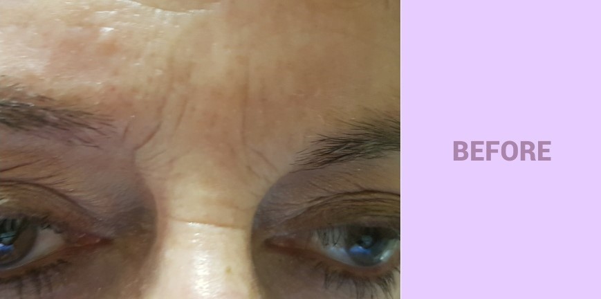 Lamprobe Offering CIT 001A