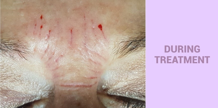 Lamprobe Offering CIT 002A