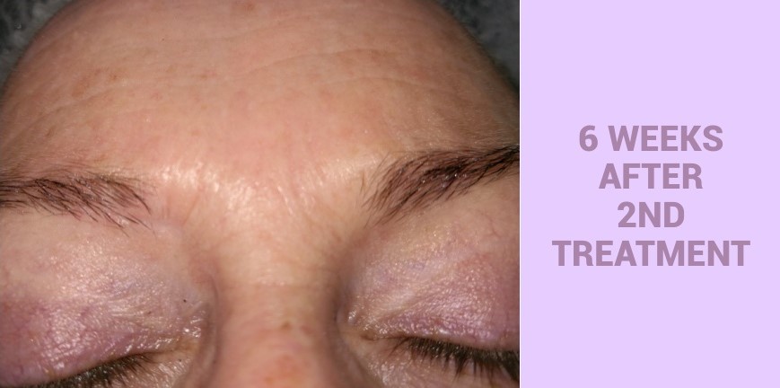 Lamprobe Offering CIT 004A