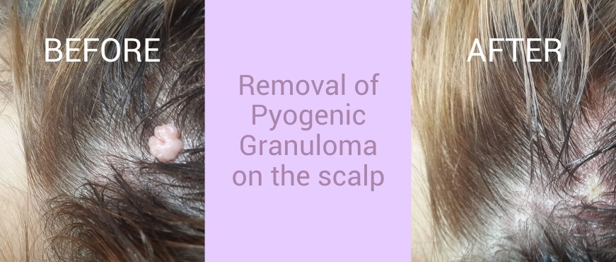 Updated Images BEFORE AND AFTER 003A