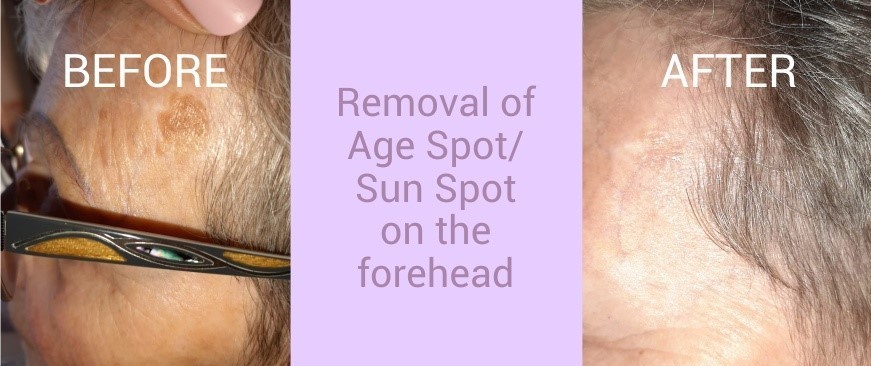 Updated Images BEFORE AND AFTER 004A